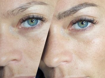 microblading1 result microblading brows cosmetic tattooing eyebrow bar semi permanent eyeliner tattoo eyelash extensions near me microblading surry hills paddington sydney salon
